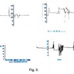 Fig. 3: