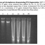 Fig. 4: Agarose gel electrophoreses demonstrating DNA fragmentation