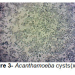 Figure 3- Acanthamoeba cysts(x100)