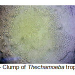 Figure 4- Clump of Thechamoeba trophozoites