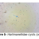 Figure 5- Hartmanellidae cysts (x100)