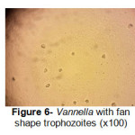 Figure 6- Vannella with fan shape trophozoites (x100)
