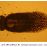 Fig. 8. Neascs vetesta obtained from the black spot on schizothoracine skin