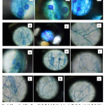 Fig. 1: Mycorrhizal Mycellium (C, F, H, I, J, K, L), Arbuscle (D, J), Vesicle (A, B, E, G) in the root cortex of studied plant (Artocarpus heterophyllus) in BCSIR reserve forest.