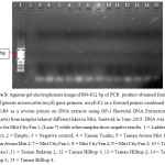Figure 3: Agarose gel electrophoresis image of 809-812 bp of PCR  product obtained from the use of generic microcystin (mcyE) gene primers, mcyE-F2 as a forward primer combined with mcyE-R4 as a reverse primer on DNA extracts using GF-1 Bacterial DNA Extraction Kit (Vivantis) from samples taken at different lakes in Miri, Sarawak in June 2015. DNA was only visible for Miri City Fan 1, (Lane 7) while other samples show negative results. 1 = Ladder (VC 100bp); 2 = Empty; 3 = Negative control; 4 = Taman Tunku; 5 = Taman Awam Miri 1; 6 = Taman Awam Miri 2; 7 = Miri City Fan 1; 8 = Miri City Fan 2; 9 = Miri City Fan 3; 10 = Taman Bulatan 1; 11 = Taman Bulatan 2; 12 = Taman Hilltop 1; 13 = Taman Hilltop 2; 14 = Taman Hilltop 3; 15 = Taman Hilltop 4.