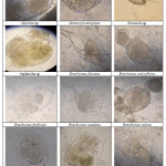 Zooplankton of class Rotifera