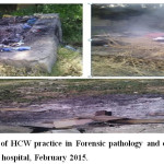 Figure 4: Open burning of HCW practice in Forensic pathology and orthopedic ward case teams in Menellik II hospital, February 2015.
